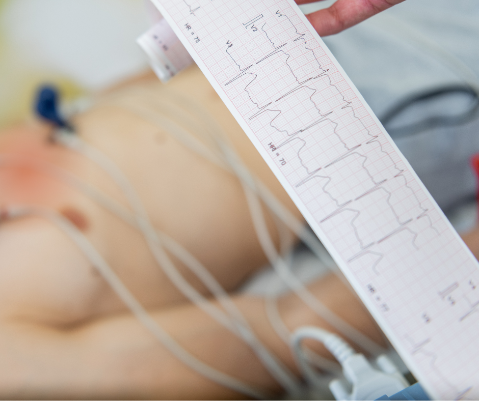 Aritmologa konsultācija – sirds ritma traucējumu diagnostika MedicalBridge Clinic (Rīga/Ulbroka)