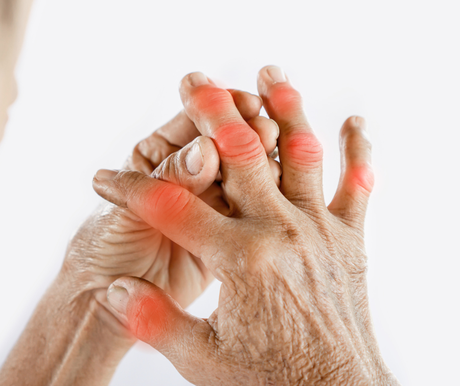 Reimatologa konsultācija locītavu sāpju un iekaisuma slimību izvērtēšanai MedicalBridge Clinic