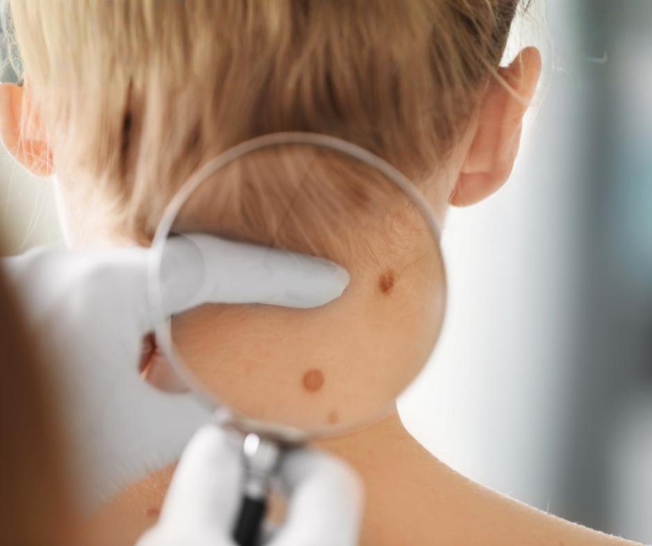 Dermatologa konsultācija ādas, matu un nagu veselības izvērtēšanai MedicalBridge Clinic